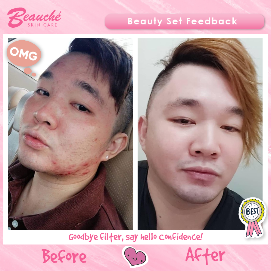 Beauche Beauty Bar Soap 150g - Bigger!