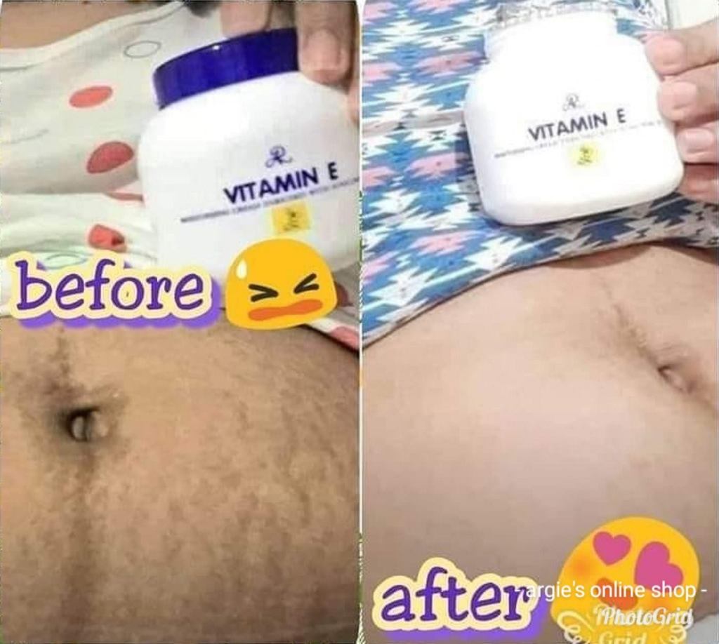 AR Vitamin E Moisturising Cream With Sunflowers Oil 500 ml tub