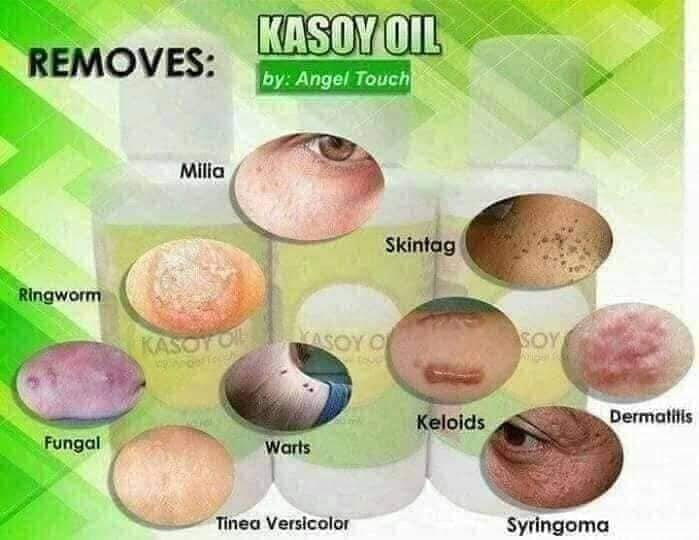 Kasoy Oil 60ml