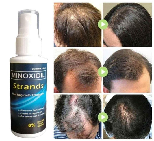 Minoxidil Strands 6% Hairgrower For Men and Women 60ml