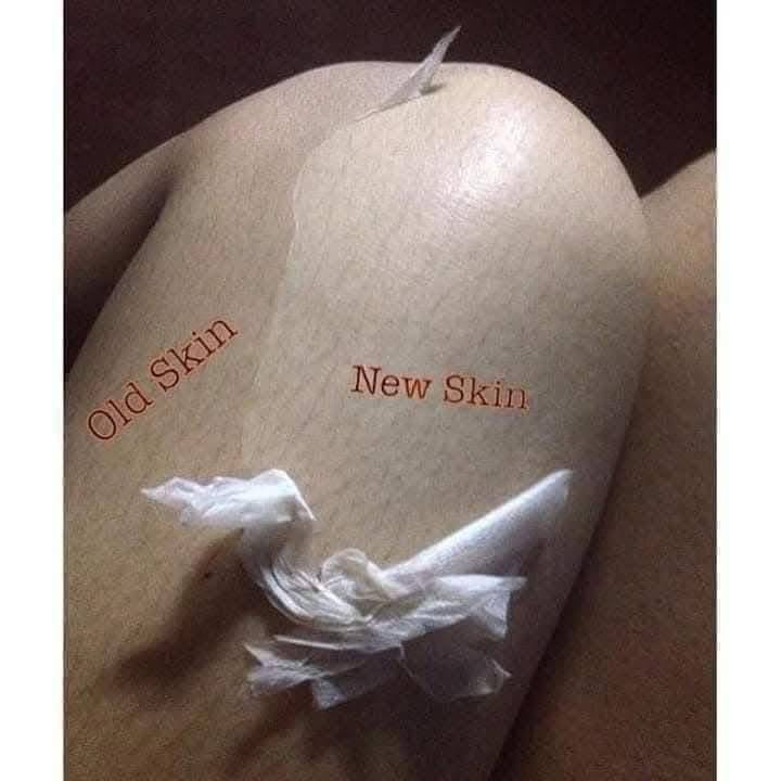 SkeenCare Peeling Lotion 100ml