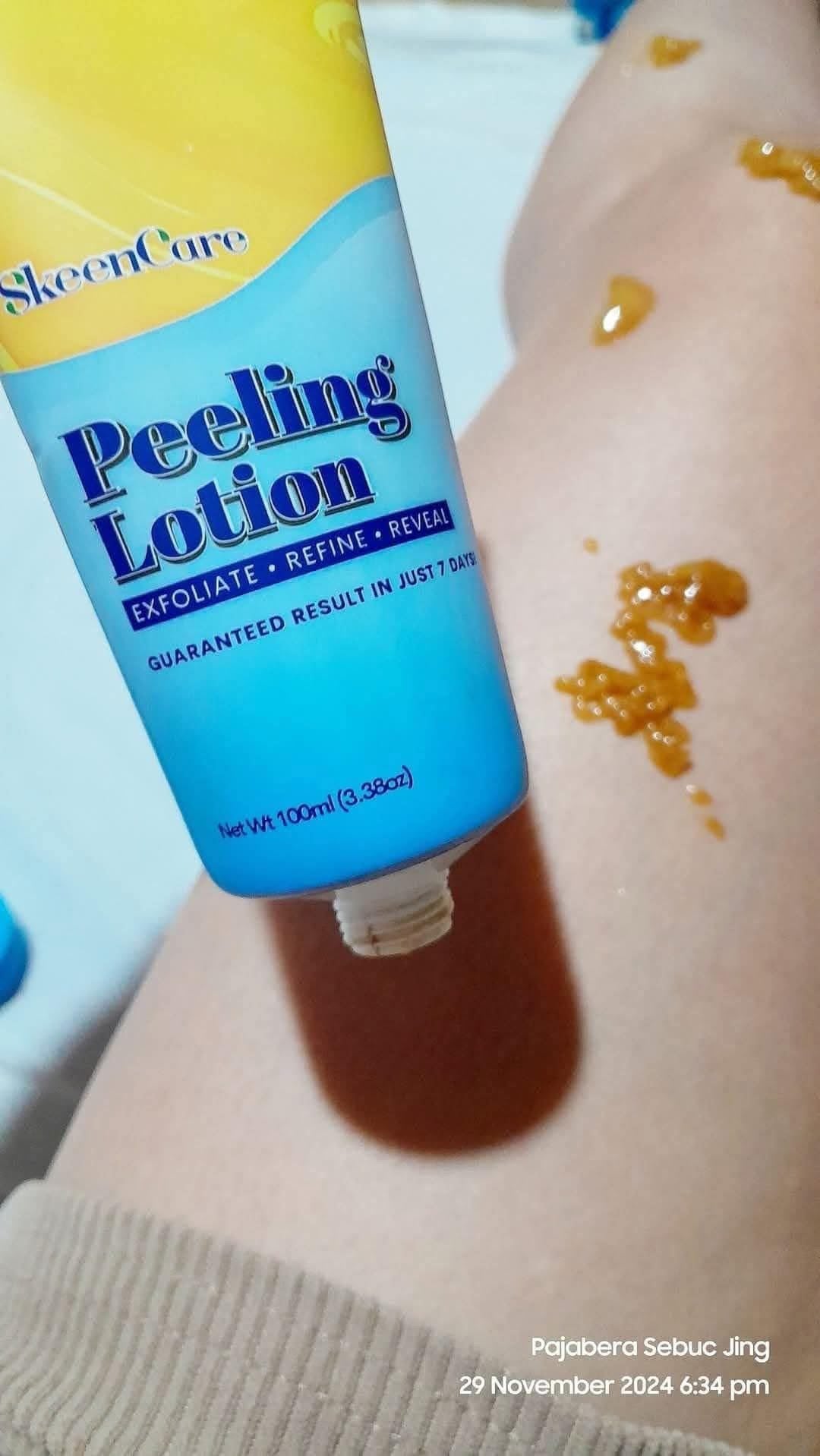 SkeenCare Peeling Lotion 100ml