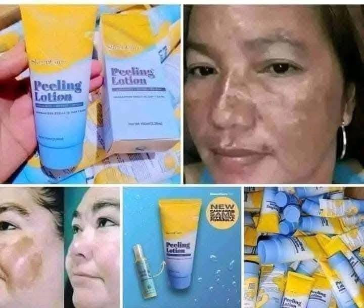 SkeenCare Peeling Lotion 100ml