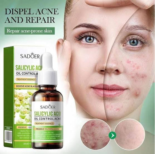 SADOER Salicylic Acid Oil Control Acne Treatment Essence 30ml