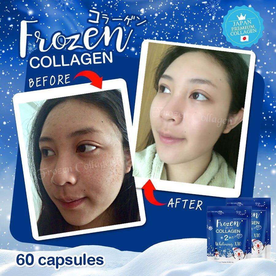 Frozen Collagen 2 in 1 Whitening x10