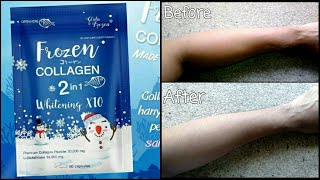 Frozen Collagen 2 in 1 Whitening x10