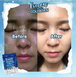 Frozen Collagen 2 in 1 Whitening x10