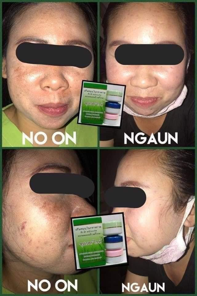Meyyong Seaweed Super Whitening Cream Set