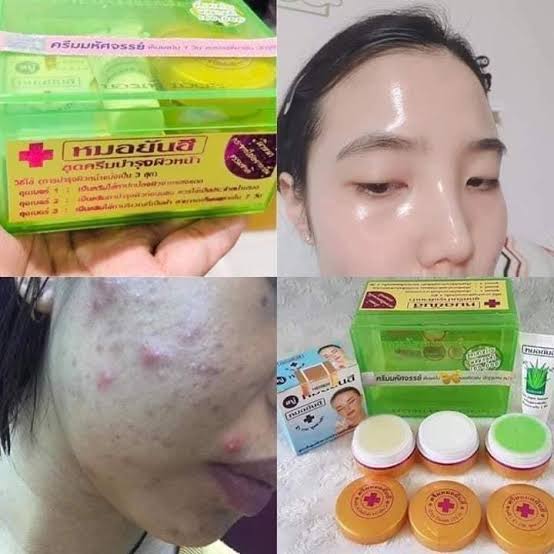 Dr. Yanhee Facial Set (Anti-Acne)