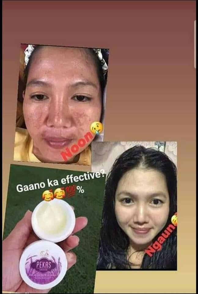 Pekas Eraser Cream by Capadosa 10g