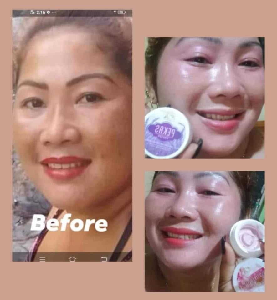 Pekas Eraser Cream by Capadosa 10g