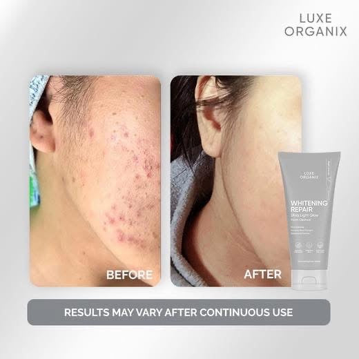 Luxe Organix Whitening Repair Ultra Light Glow Foam Cleanser 150g