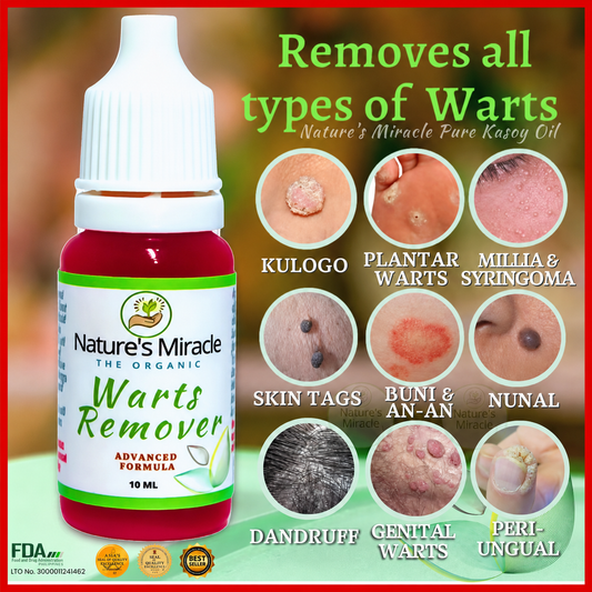 Nature’s Miracle Organic Warts Remover – 10ml (Kasoy Oil)