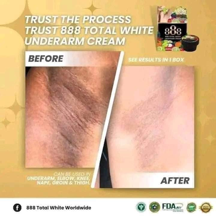 888 Total White Underarm Cream