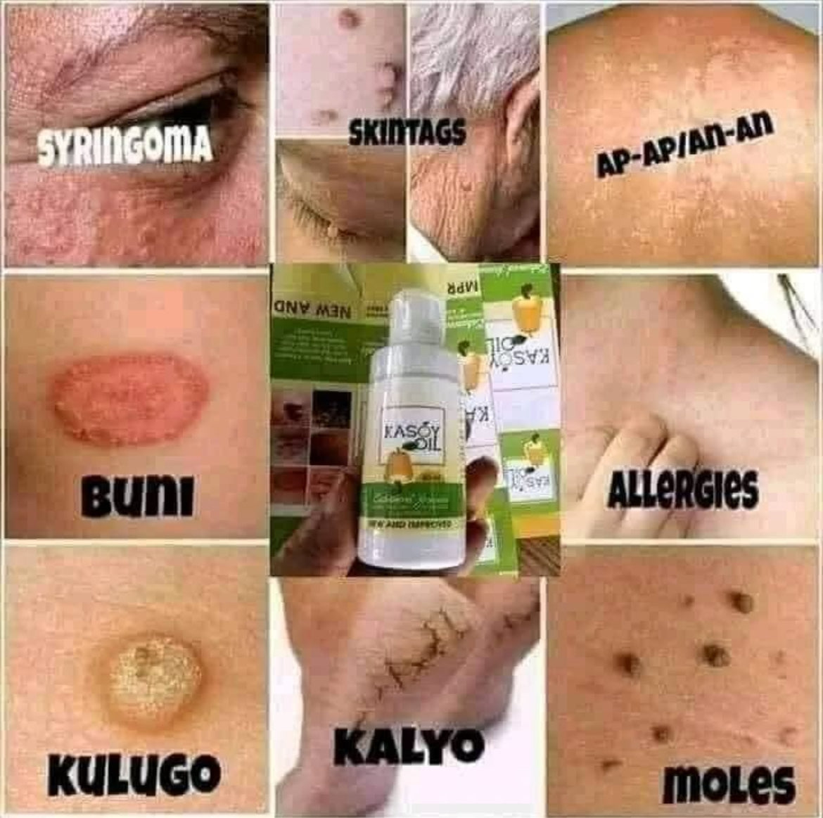 Kasoy Oil 60ml