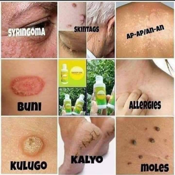 Kasoy Oil 60ml