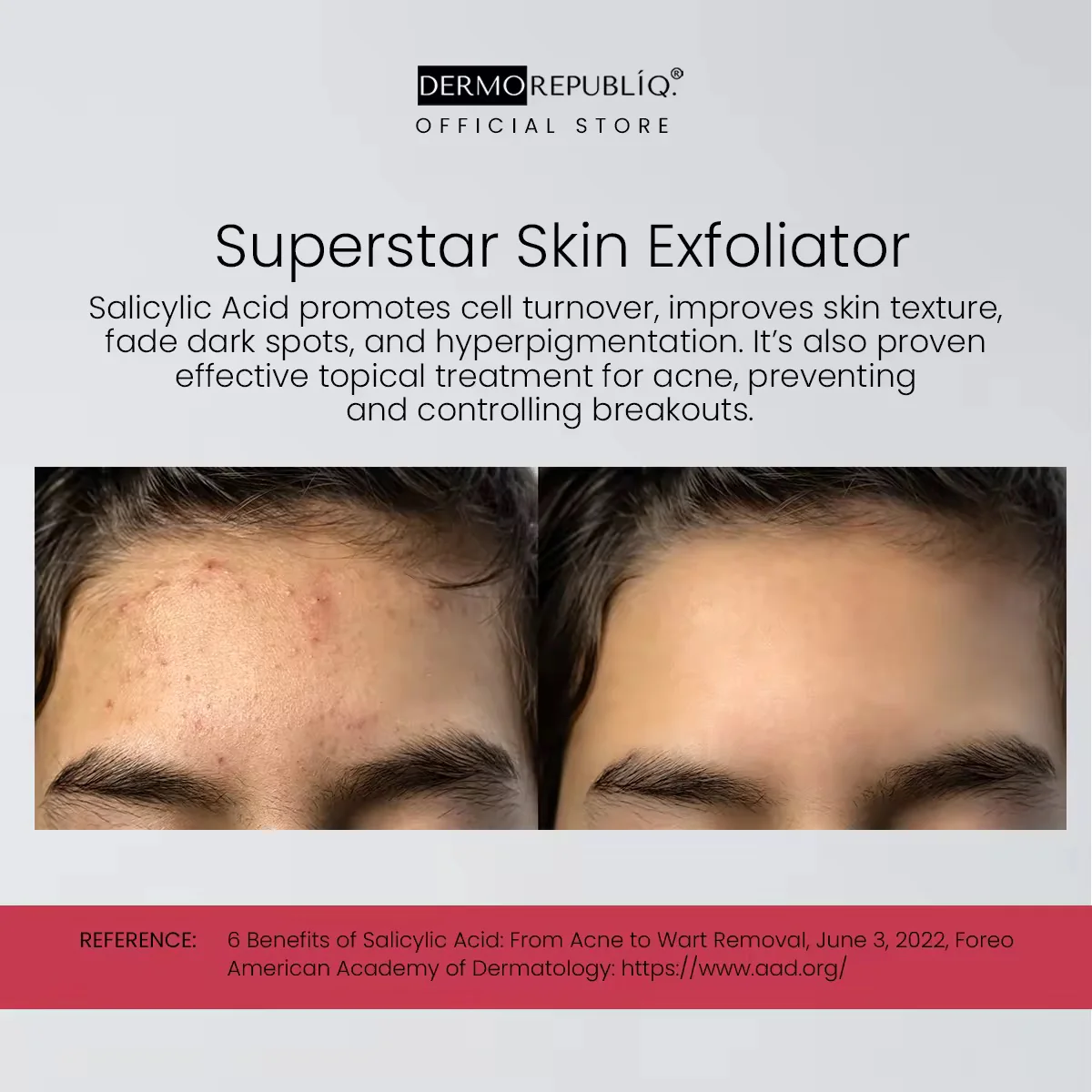 Dermo Republiq Toner 7% Glycolic Acid ( AHA ) 100 ml