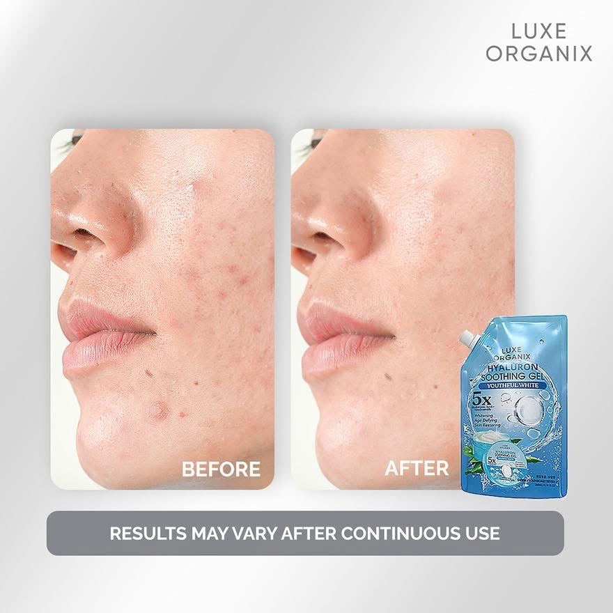 Luxe Organix Hyaluron Soothing Gel Youthful White – 200ml