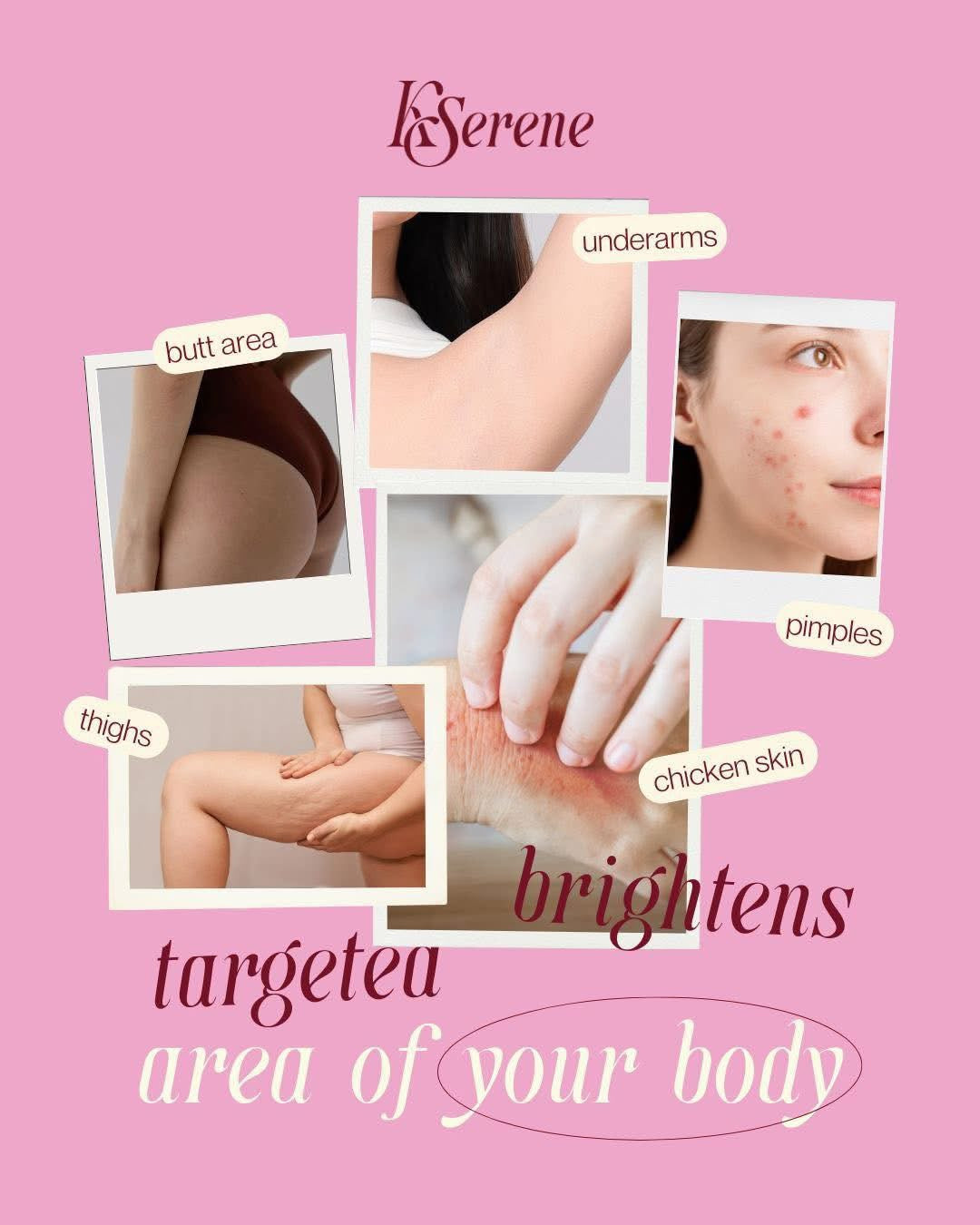 KiliBum Soap (Gluta Gycolic) 3 x 70g