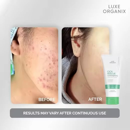 Luxe Organix Cica Rescue Gentle Brightening Low pH Daily Cleanser 150ml