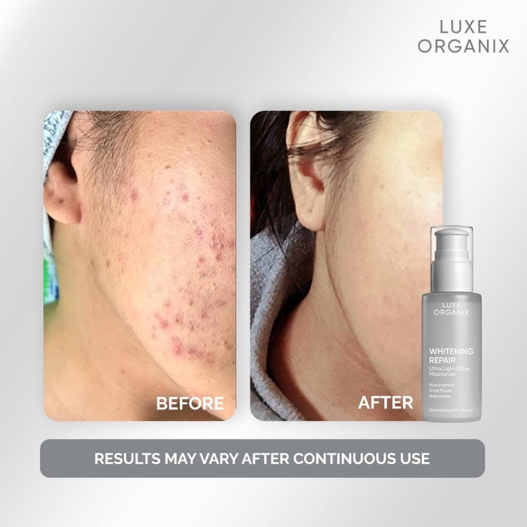 Luxe Organix Whitening Repair Ultra Light Glow Moisturizer 80ml