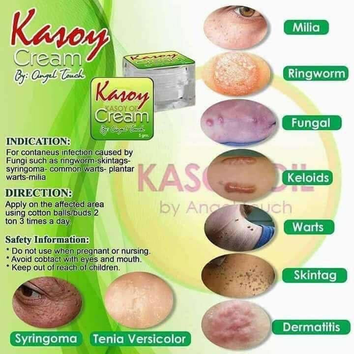 Kasoy Cream 10g
