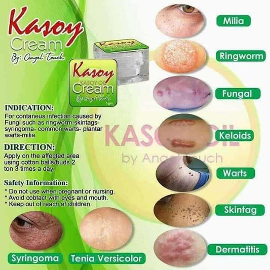 Kasoy Cream 10g