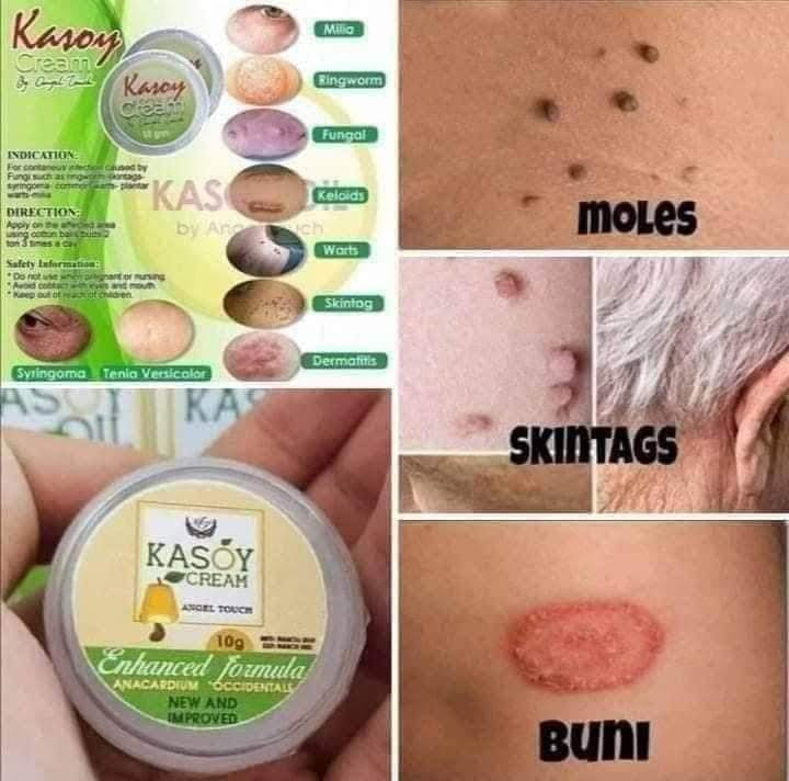 Kasoy Cream 10g