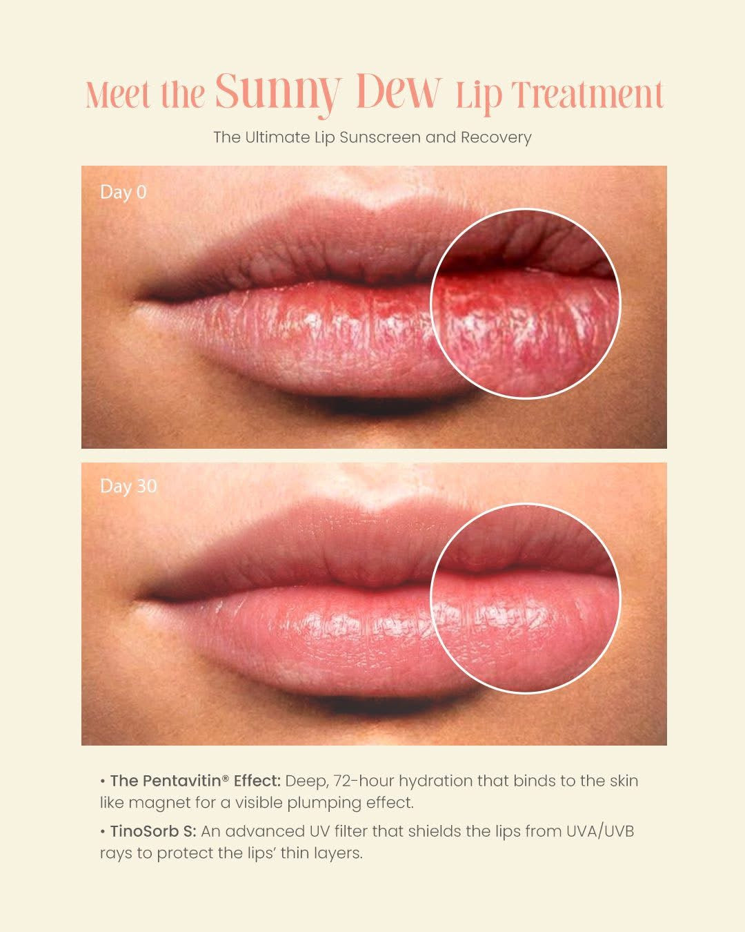 Fairy Skin Sunny Dew Lip Treatment SPF50 PA++++  12ml