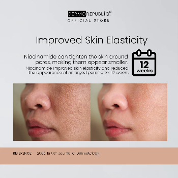 DermoFace Niacinamide Acne & Oil Control Bar Soap – 135g