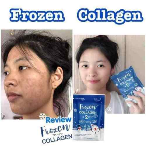 Frozen Collagen 2 in 1 Whitening x10