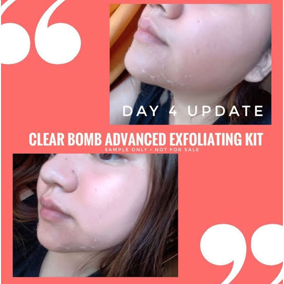 Ryx Skincerity Clear Bomb Set